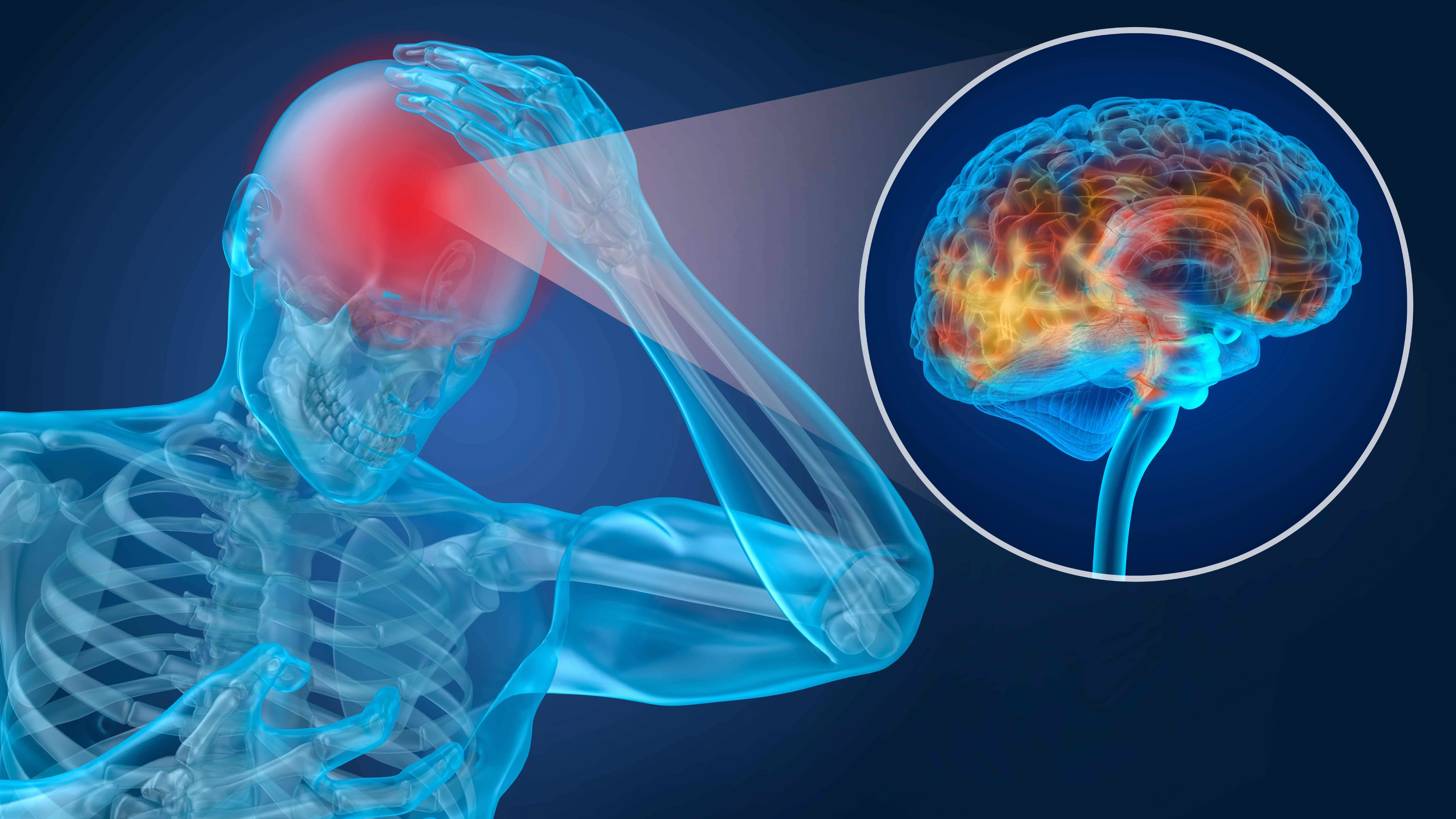 Why we still know so little about concussion